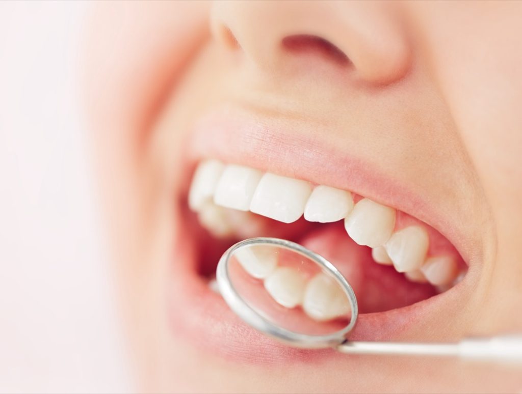 Dental Crowns or Cavity Fillings Treatment Near Me in La Palma