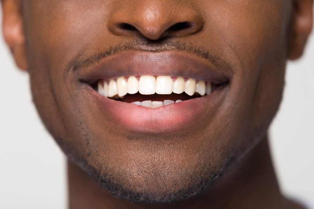 Best Dentist Near Me in La Palma, ca